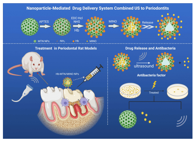 载米诺环素的二氧化钛纳米颗粒在牙周病治疗中的应用研究