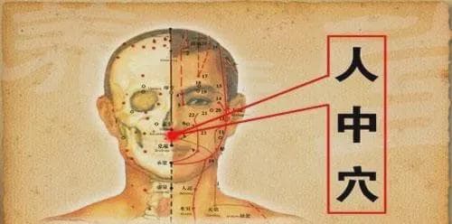 “十二针灸口诀” 解析，值得收藏