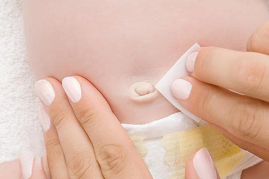 新生儿为何不能用颠碘伏消毒脐带？原来是浓度问题