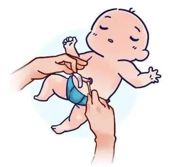 新生儿脐带护理新观点：清洁干燥胜过消毒