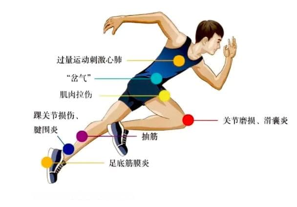 医生解析：跑步真的伤膝盖吗？这些错误跑姿要避免