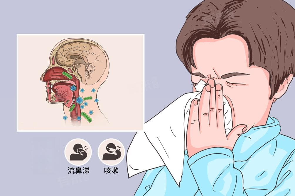 感冒的一般症状
