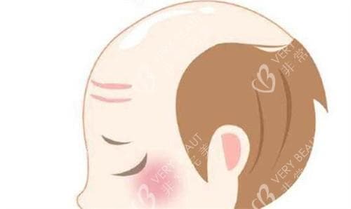 男生四指宽的发际线算高吗？发际线到眉毛几指正常？