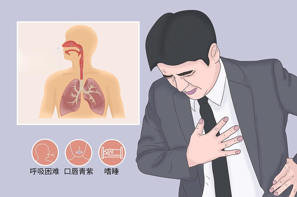 呼吸衰竭诊断金标准