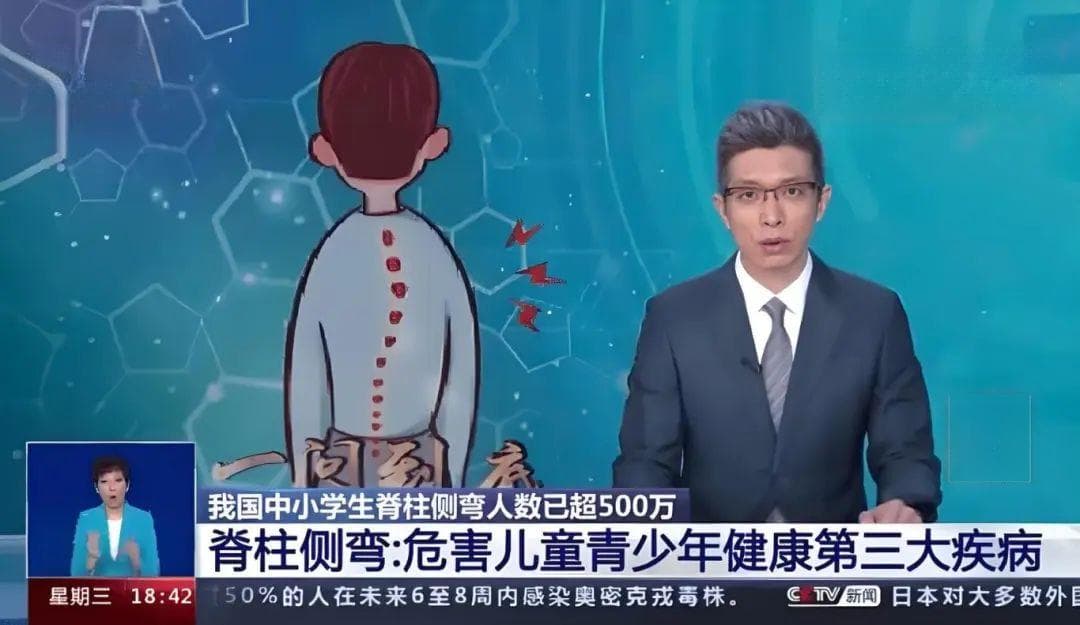 当心！脊柱侧弯误区多，小心别中招！脊柱医生揭秘常见误解→