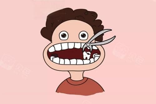 拔牙后出现白色假膜怎么办？一文详解其成因、脱落时间和注意事项