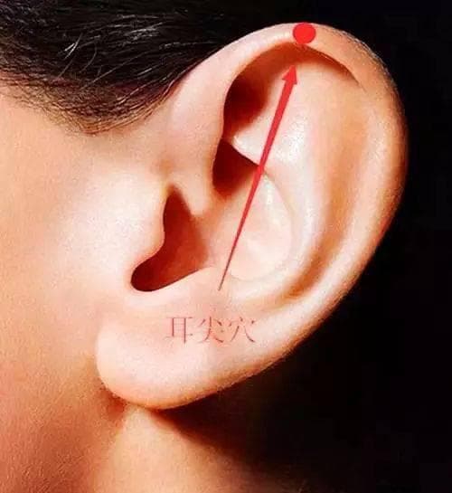 耳尖放血疗法：原理、适应症、禁忌症及操作指南