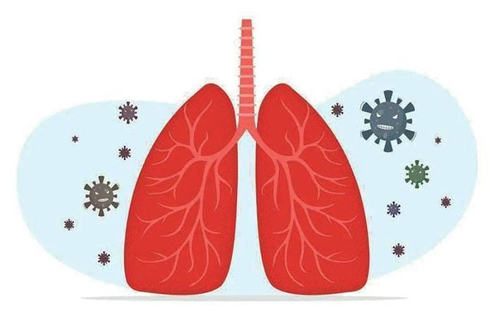 结核病的症状、诊断以及治疗