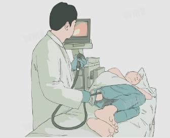 做肠镜一个人去可以吗