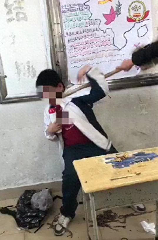 广东一初一男生遭拖把打脸 校园欺凌事件引关注