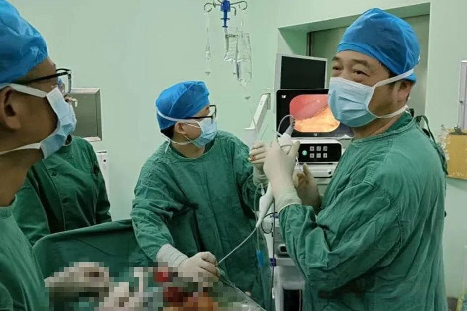 经皮经肝胆道镜取石术（PTCS） 成功解决复杂肝内胆管结石难题