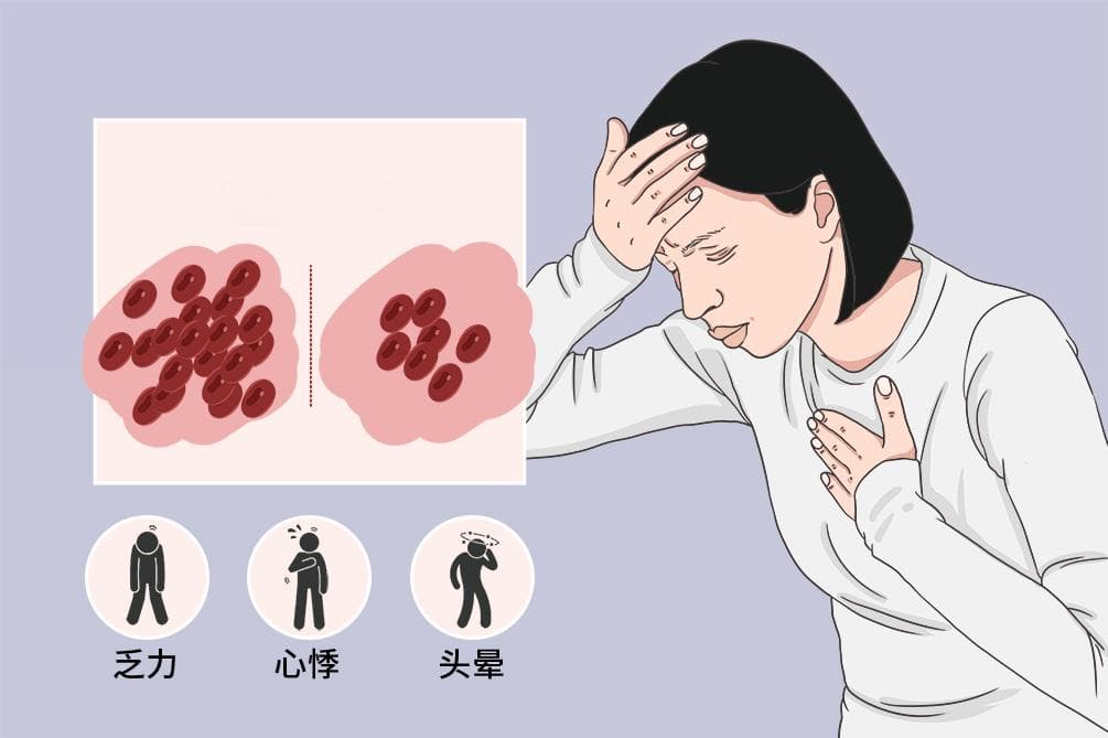 缺铁性贫血
