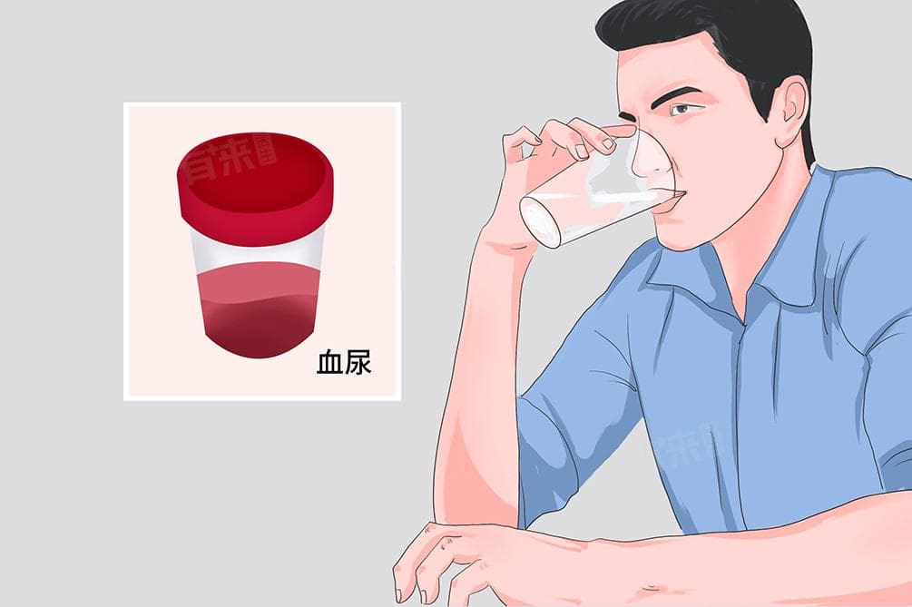 尿有血是什么原因