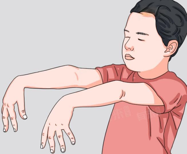 为什么会梦游？是什么原因造成的？