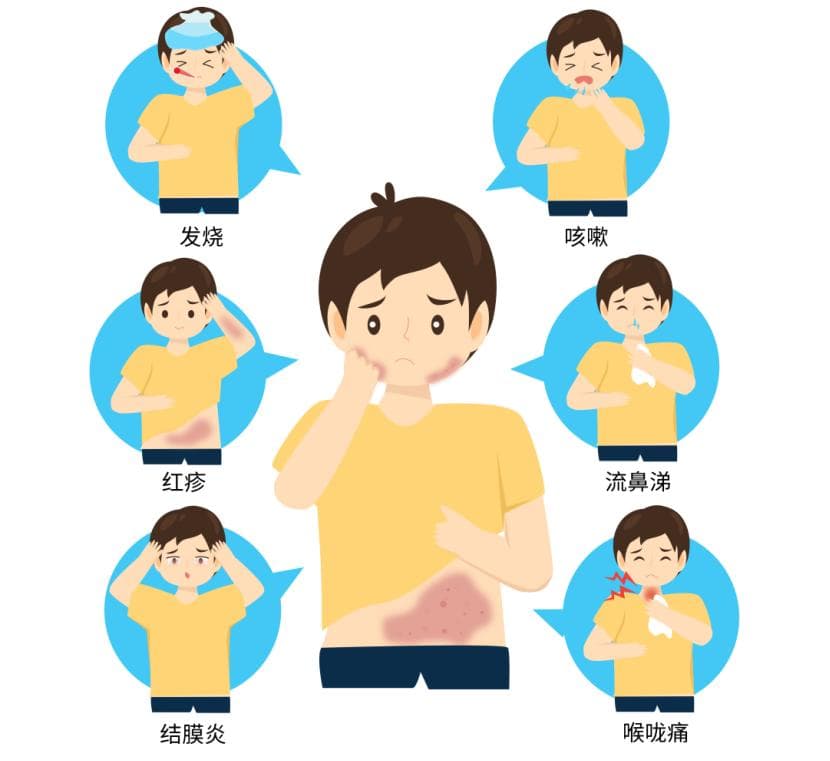 你了解麻疹吗？