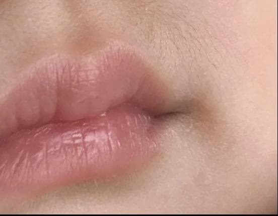 孩子唇毛深要担心吗？有这些情况要警惕性早熟