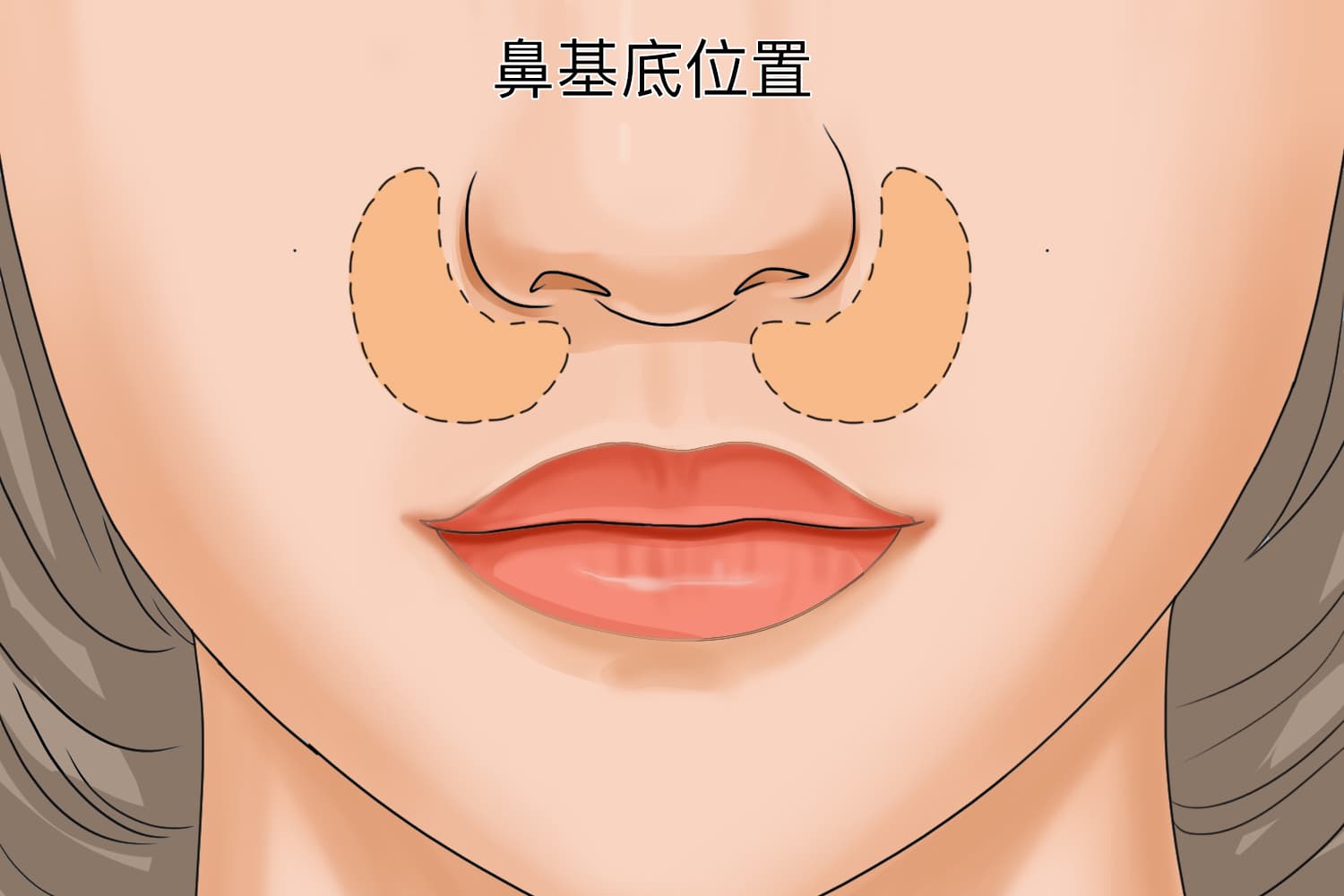 如何判断鼻基底是否凹陷？5种实用观察方法