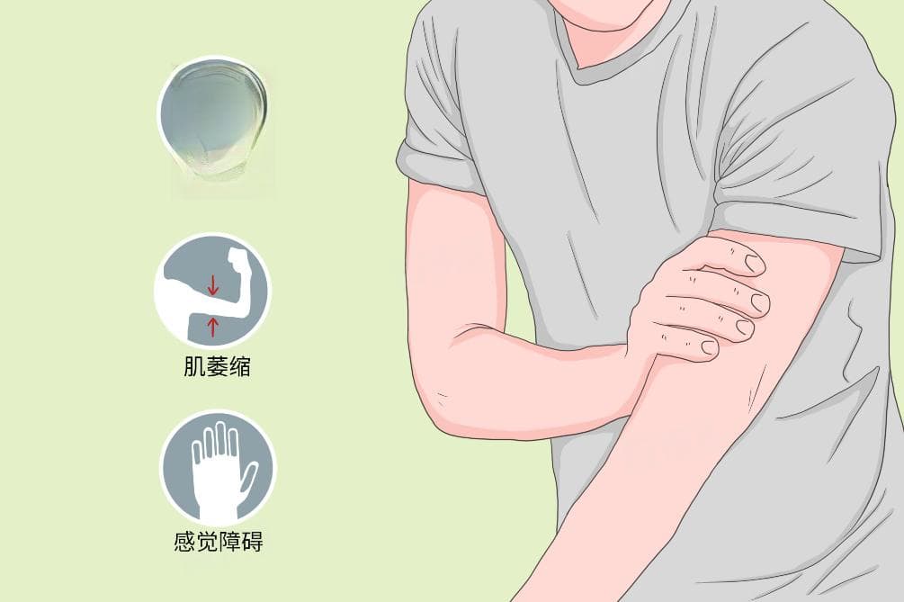 脱髓鞘是一种什么病
