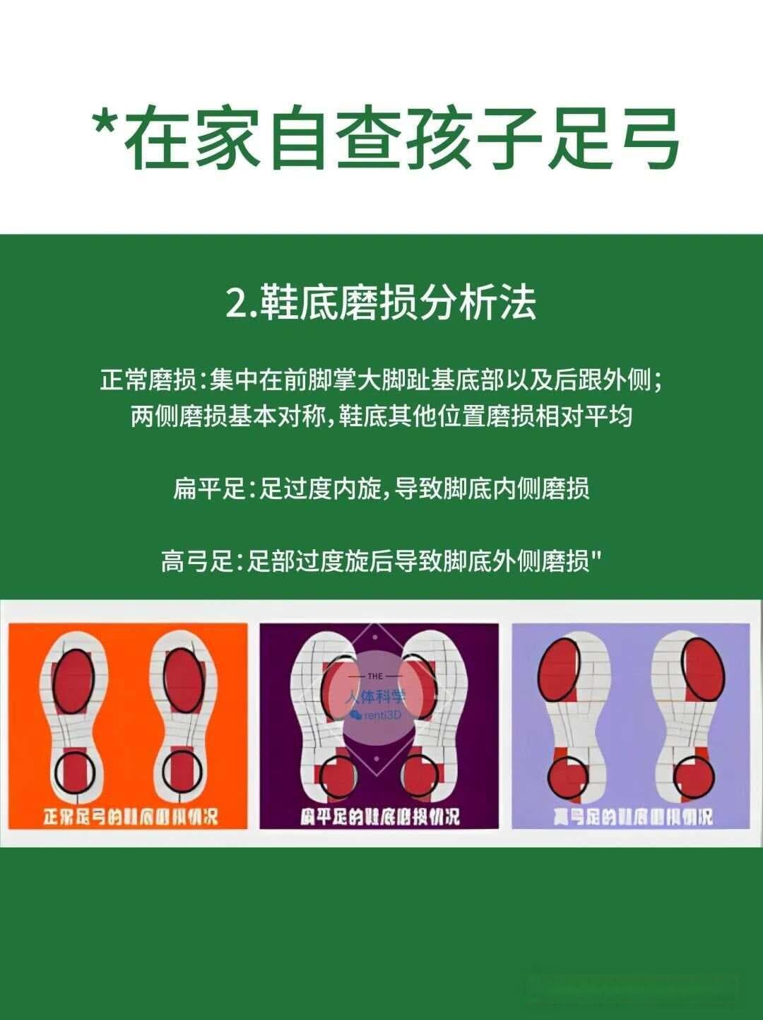 【体态评估】足弓对腿型和身体力线的影响