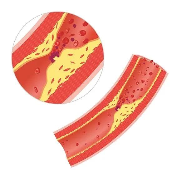 中焦堵塞四大症状与疏通法：从拍打经络到饮食调理