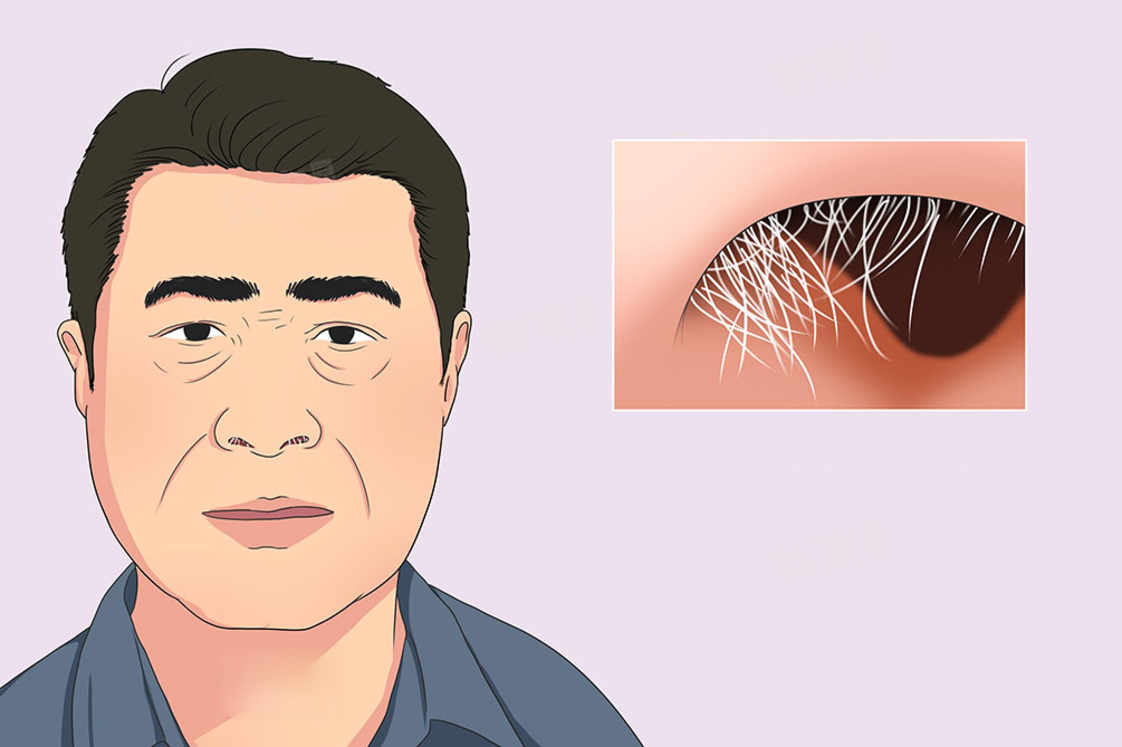 白色鼻毛是什么原因