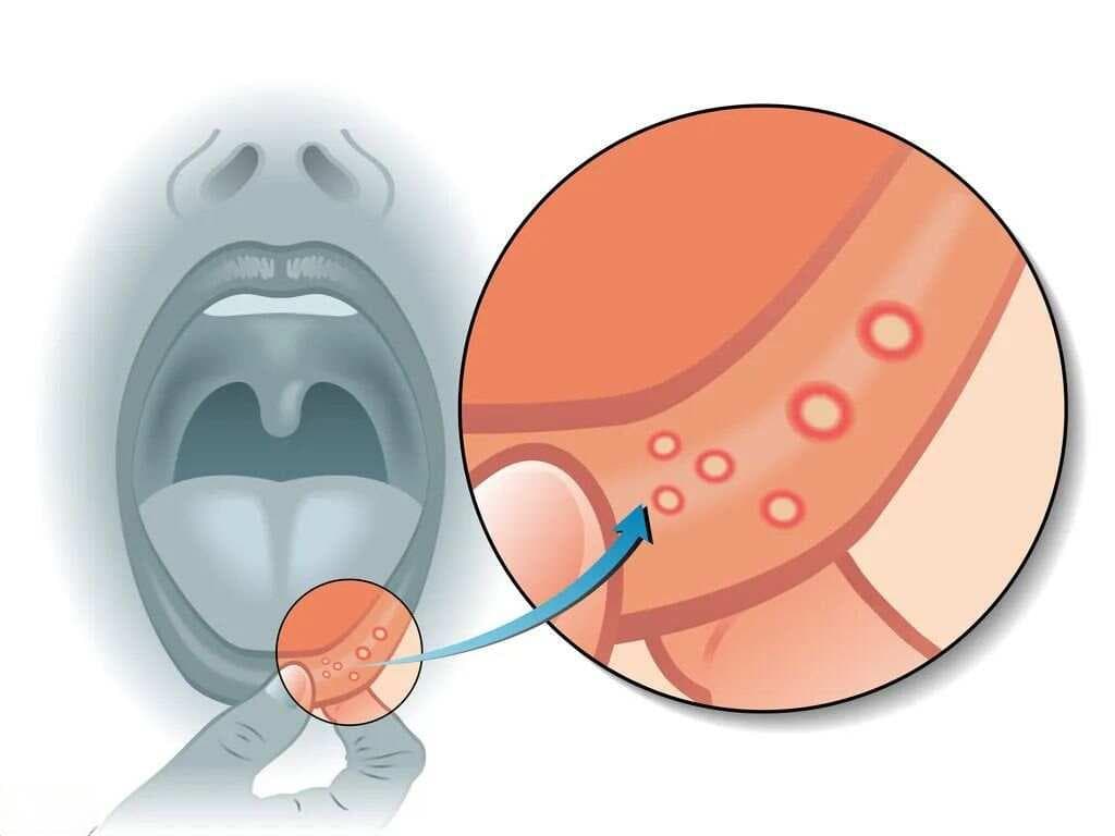 舌头的8种异常表现及其健康预警
