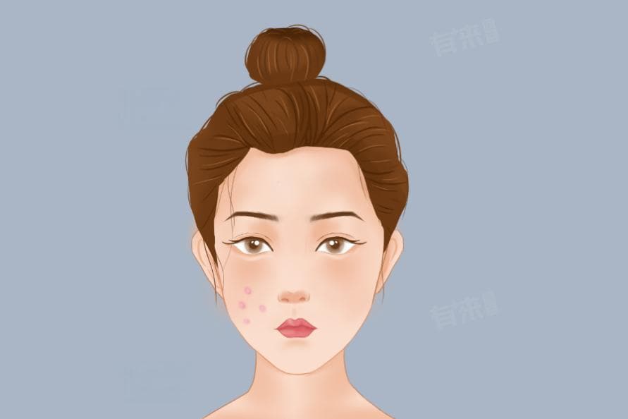 颊部是哪个部位