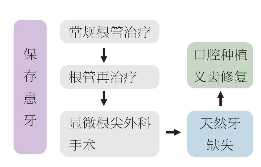 根管再治疗与显微根尖手术的选择