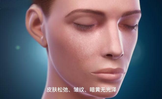 黄金微针治疗全攻略：原理、效果与术后护理注意事项