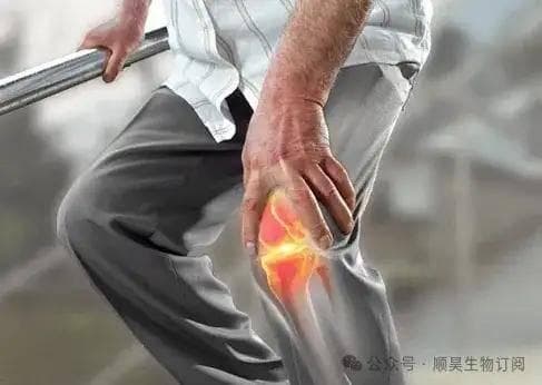 研究发现：干细胞干预膝骨关节炎，75%的患者疼痛明显减轻，效果可维持12个月
