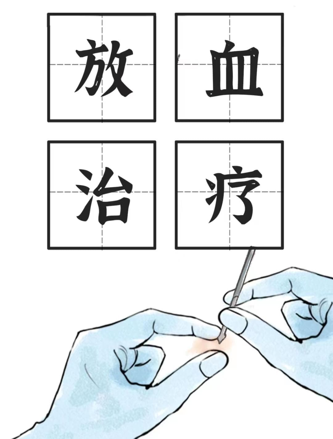 西安市第五医院（陕西省中西医结合医院）科普：中医治疗之放血疗法