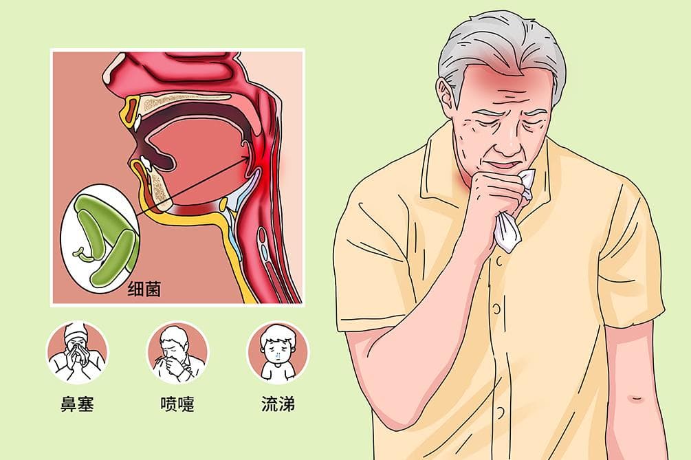 细菌性上呼吸道感染
