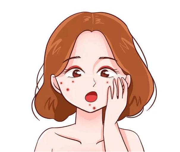后知后觉,原来粉刺跟痘痘是有区别的