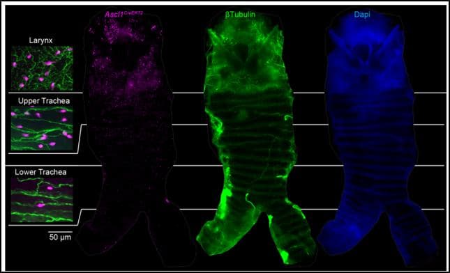 Science：新研究发现可以感知吸入的水和胃酸反流的神经内分泌细胞