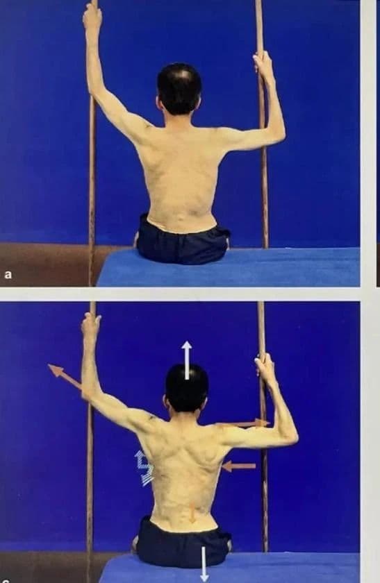 震惊！呼吸也能够矫正脊柱侧弯！