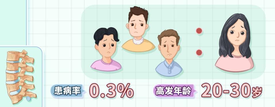 远离强直性脊柱炎的痛苦：全面治疗指南