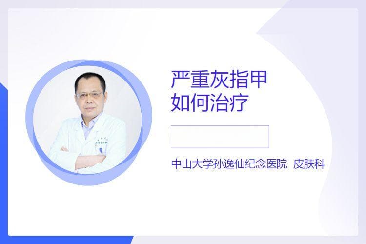 严重灰指甲如何治疗