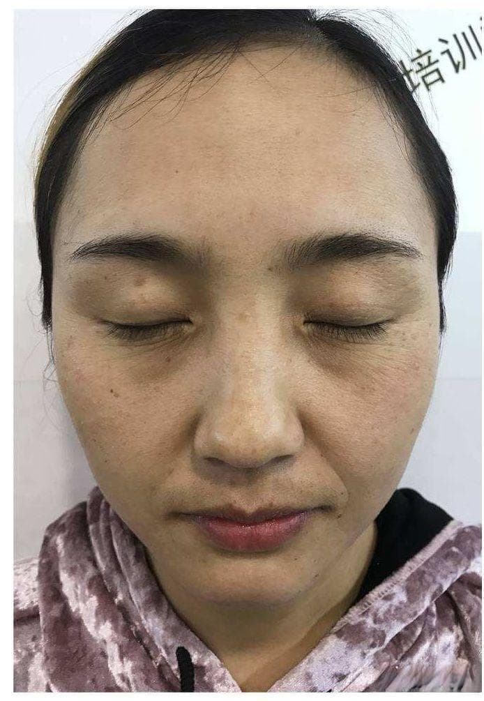 如何辨别自己的肤质？