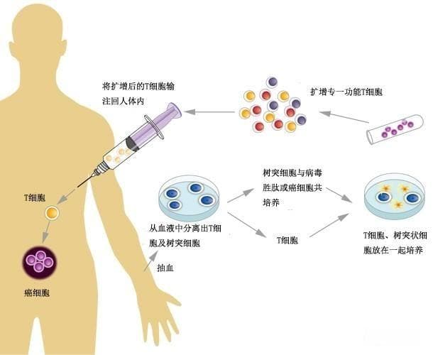一文解析肿瘤免疫治疗的原理、机制、分类