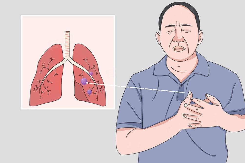 肺炎白细胞会高吗