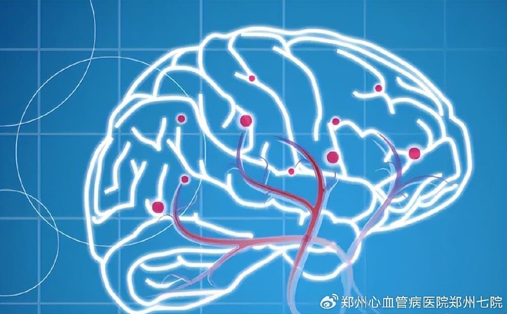 脑灌注成像检查，您了解多少？
