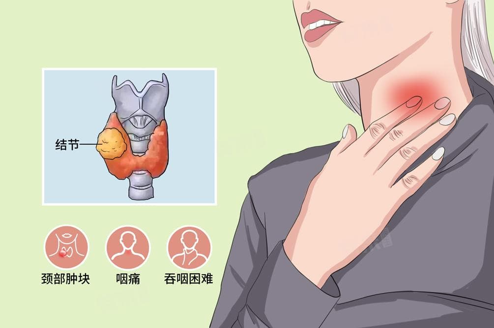 甲状腺结节边界不清晰一定是恶性吗？