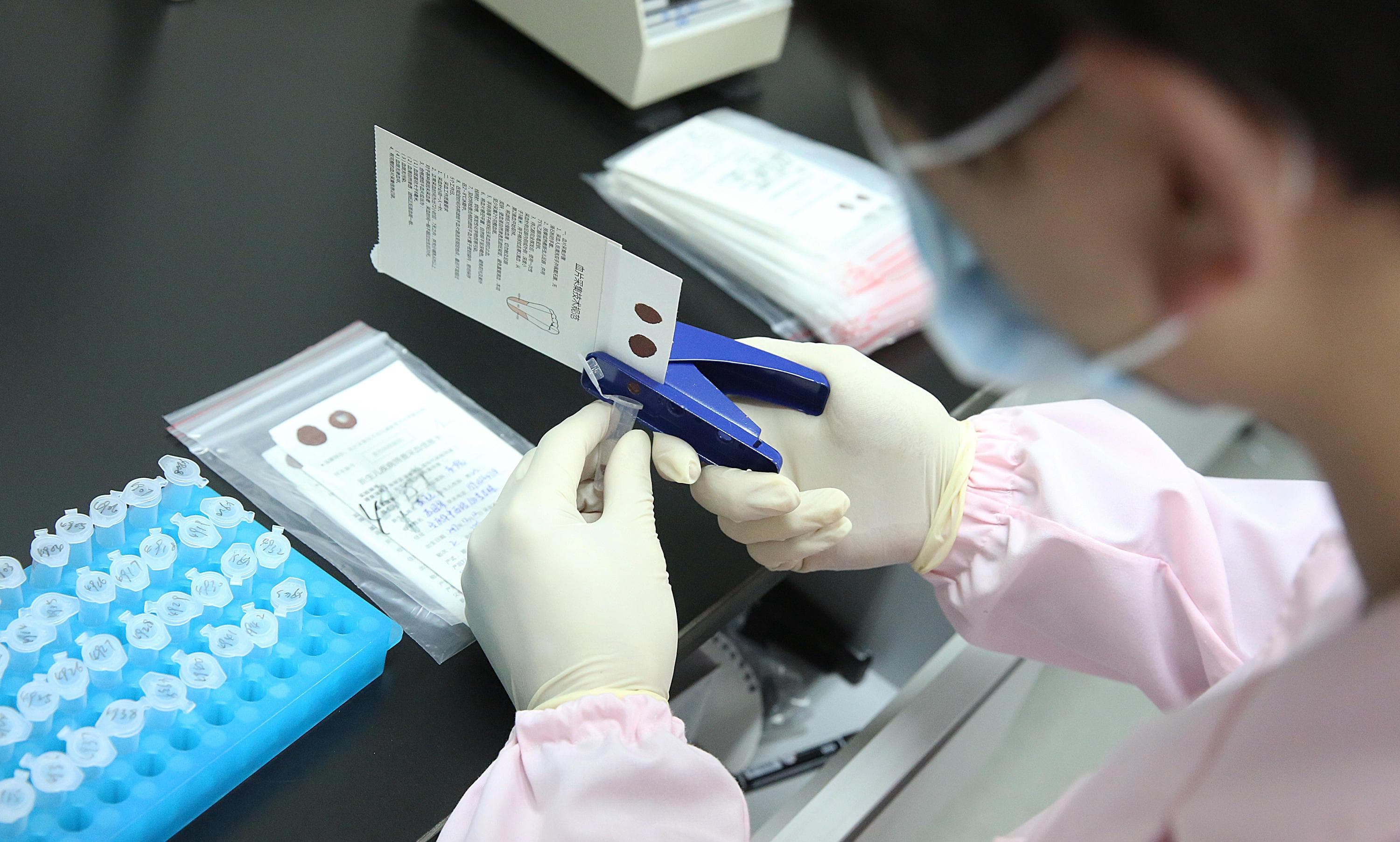 亲子鉴定中的实验室质量控制：如何避免误差和污染？