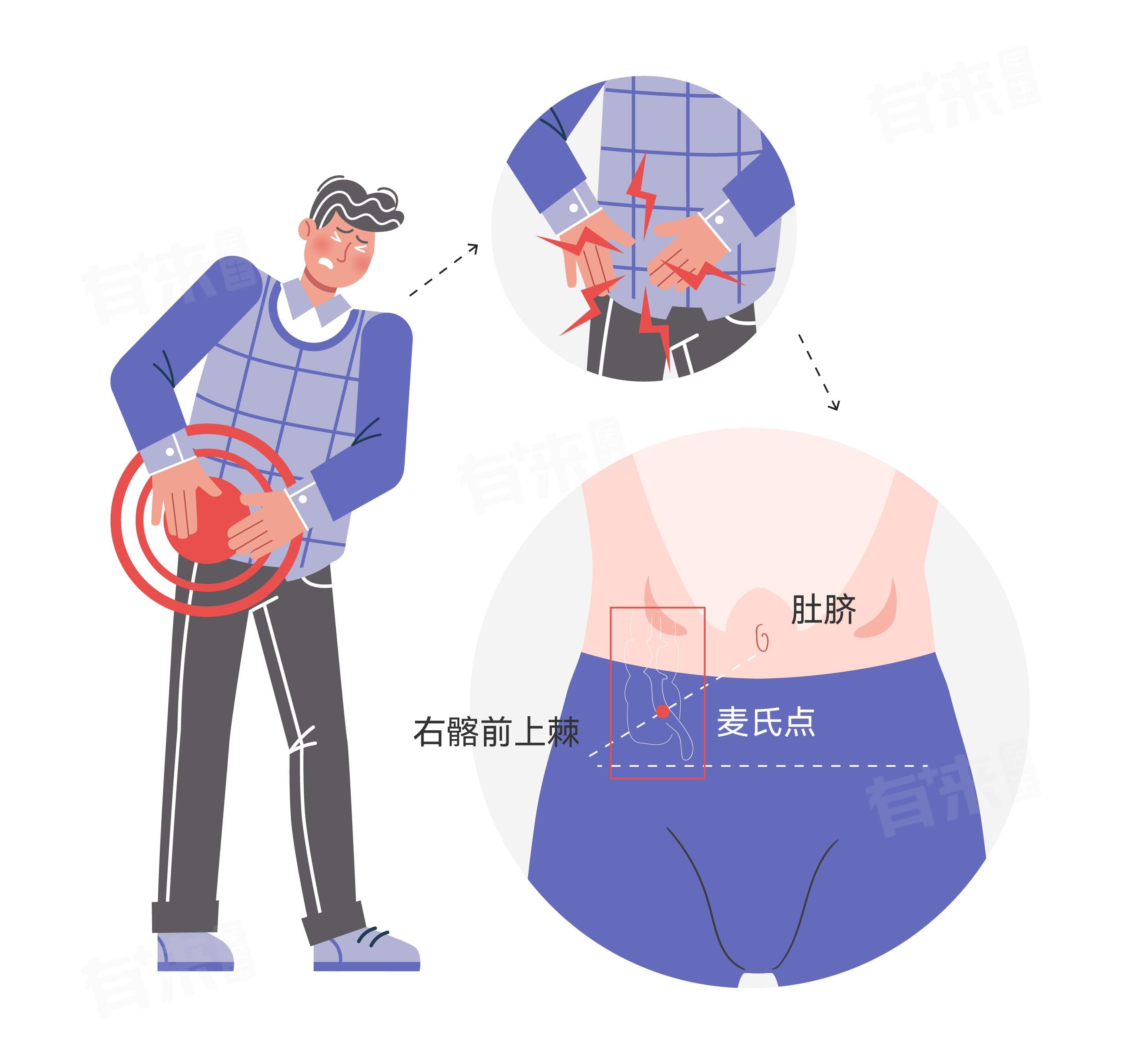 阑尾炎在哪个位置疼