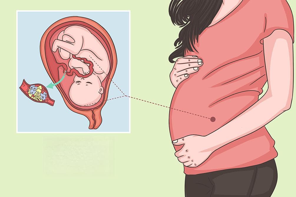 羊水栓塞：病因、症状、诊断与治疗全解析