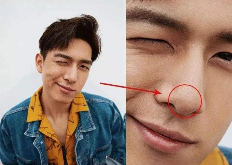 鼻子毛孔粗大有洞红红的鼻头黑头草莓鼻怎么去除？