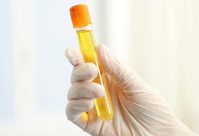 高尿酸可以吃“鱼”吗？医生提醒：若想降低高尿酸，这5物莫贪吃