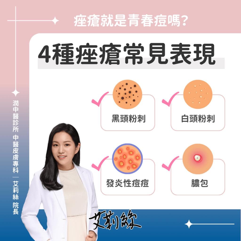 痤疮是什么？种类、成因、治疗方式 一篇看懂