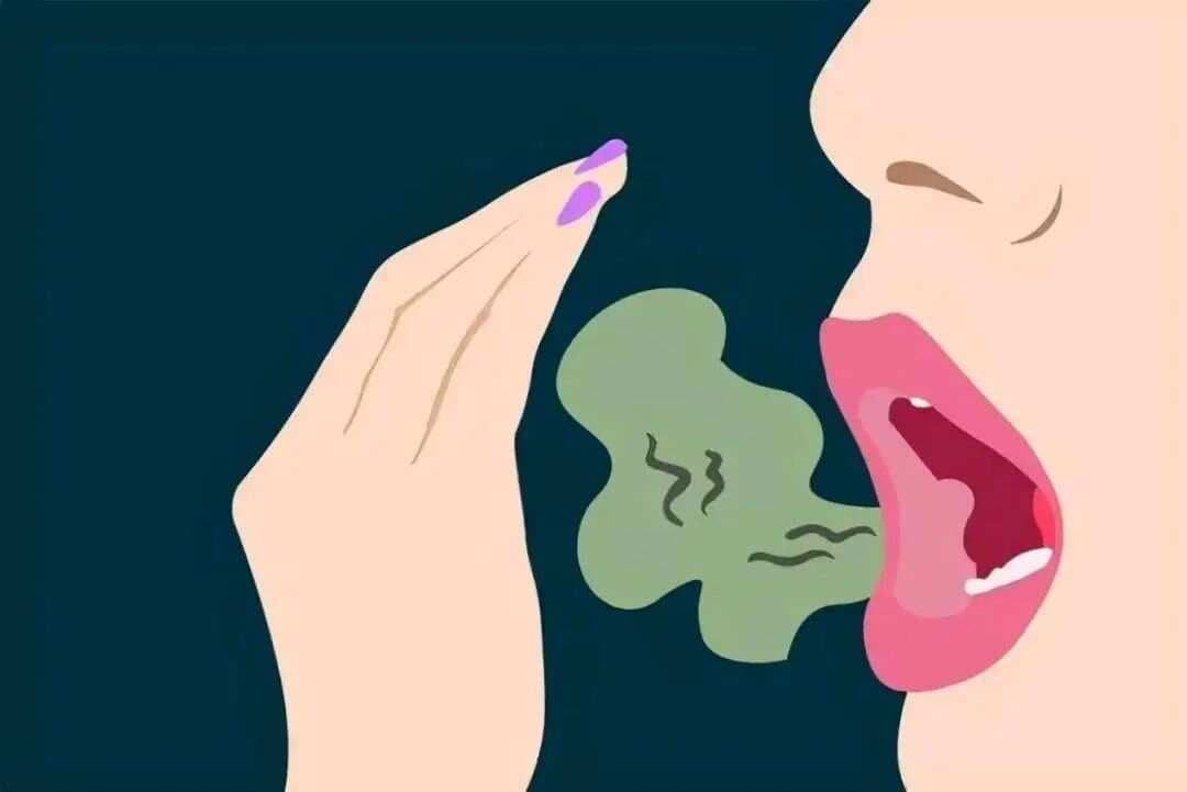 治疗口臭、口疮的12个中成药，一文总结