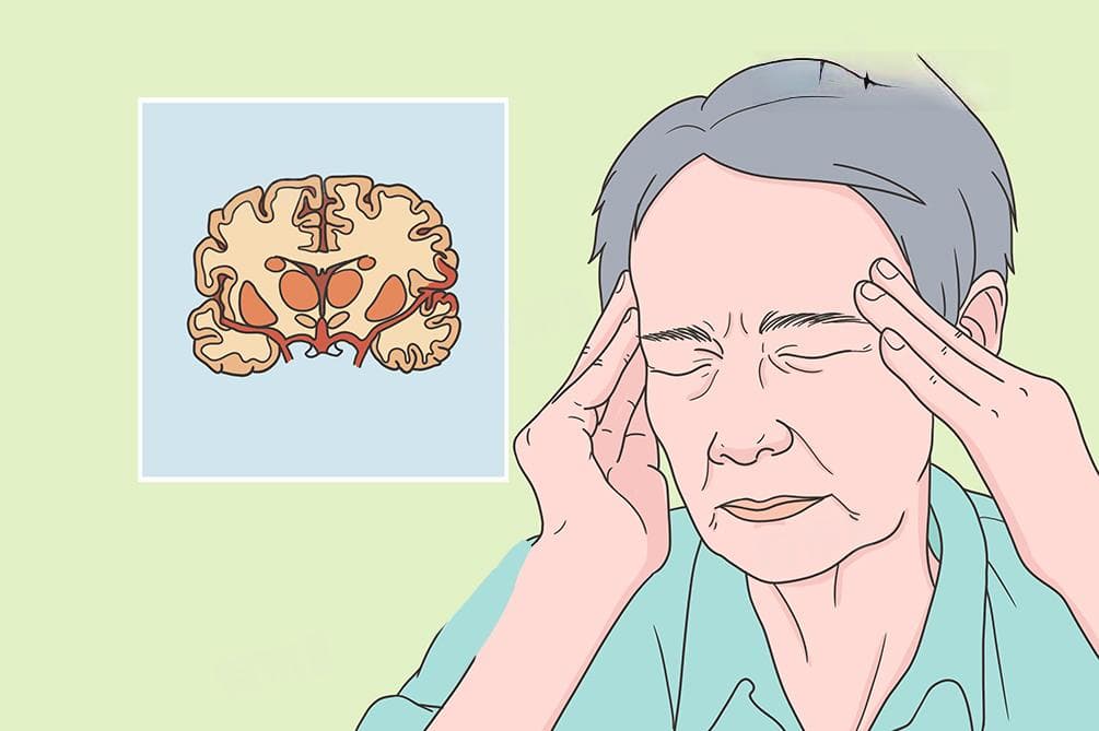 中风的基本病机与治疗方法